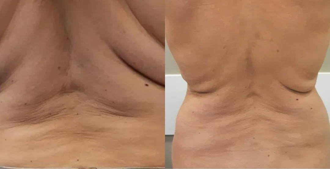 ultrassom 2