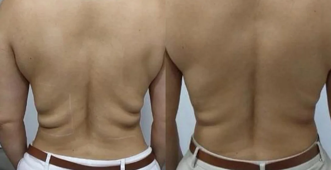 ultrassom 7